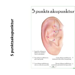 5 Punktsakupunktur i ret