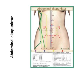 Abdominal akupunktur