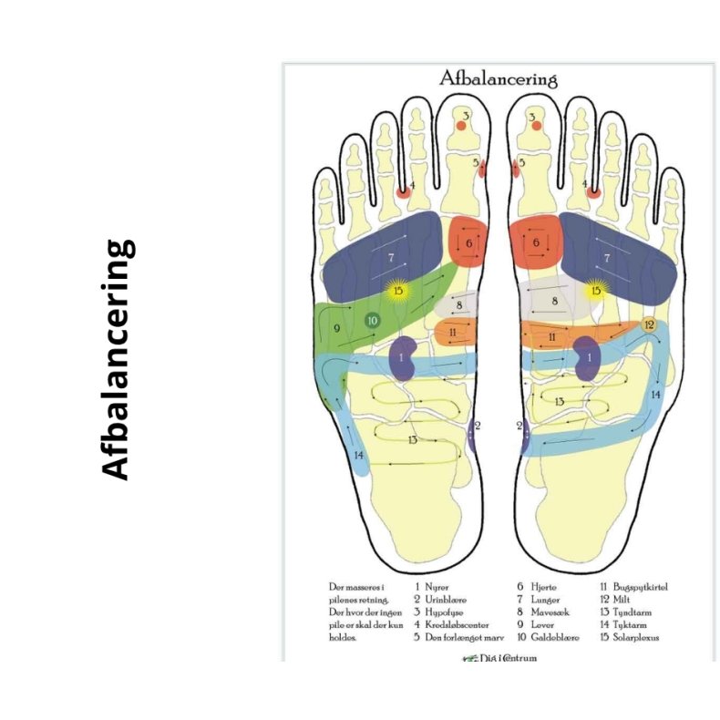 Fodzoneafbalancering