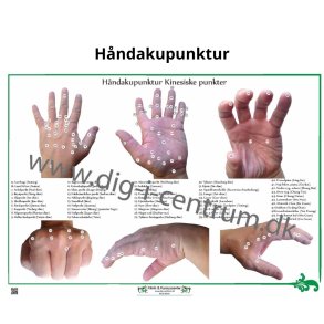 Hndakupunktur