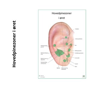 Hovedpinezoner i ret 