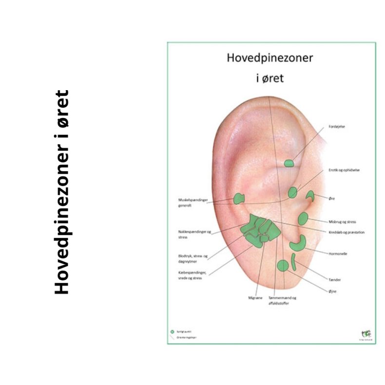 Hovedpinezoner i ret 