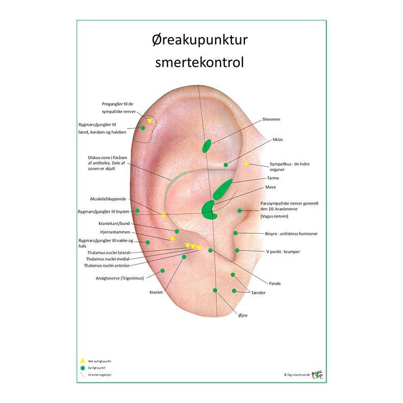 reakupunktur smertekontrol 