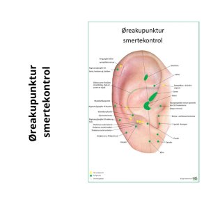 reakupunktur smertekontrol 