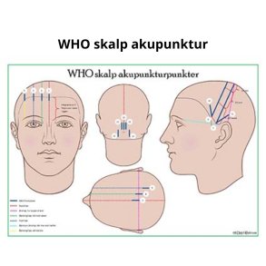 WHO skalp akupunkturpunkter