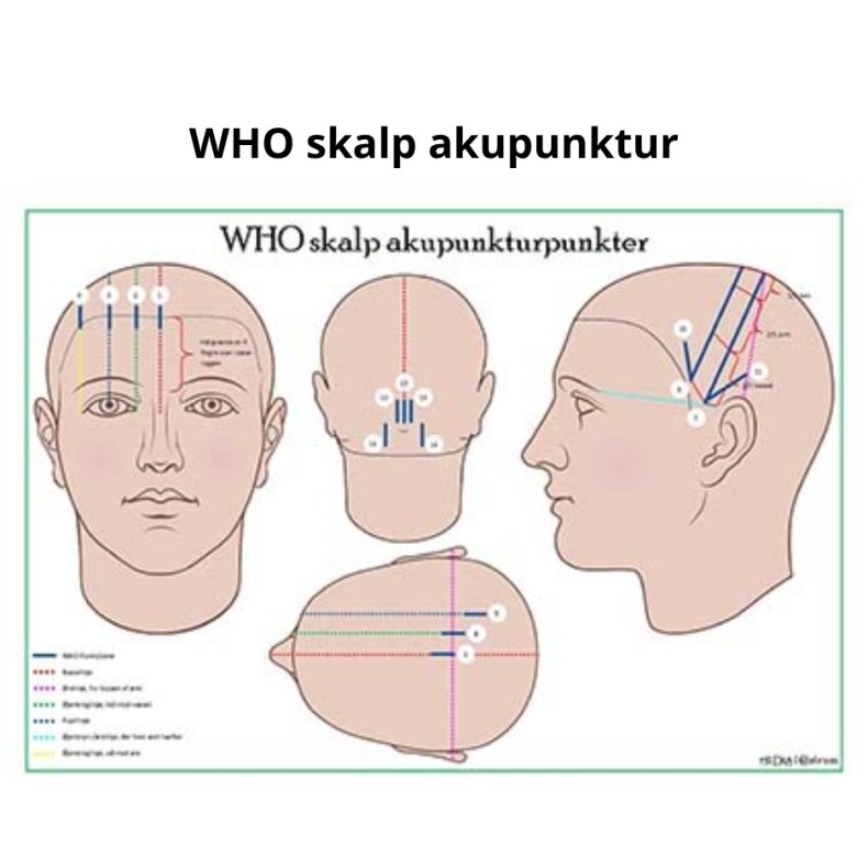 WHO skalp akupunkturpunkter