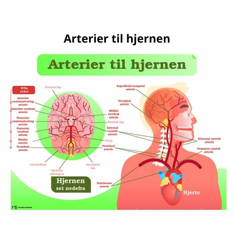 Arterier til hjernen